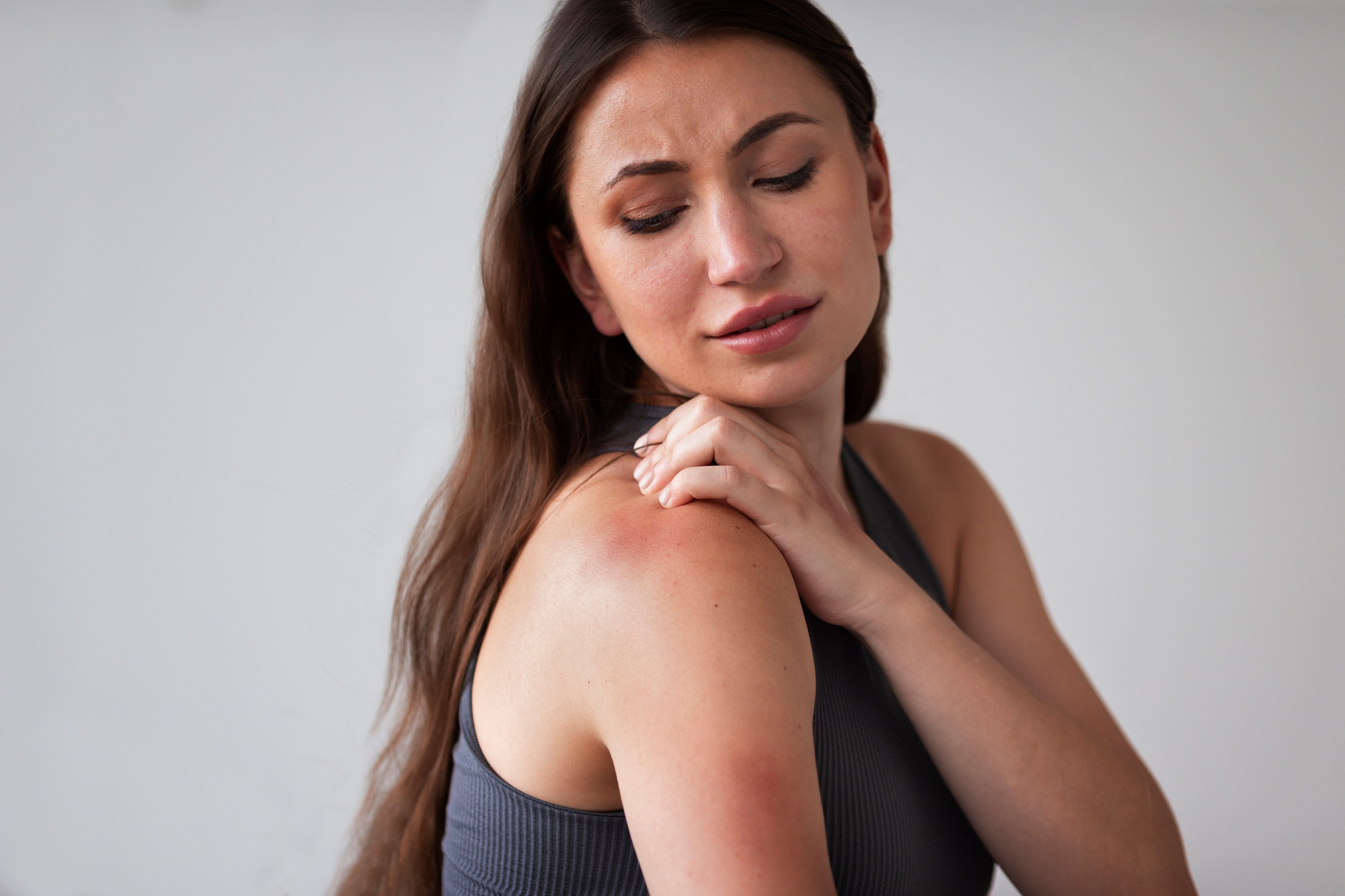 Marine Collagen Allergy Symptoms You Should Watch For